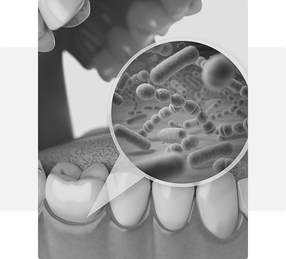 bacteria in the mouth gum disease Hixson, TN